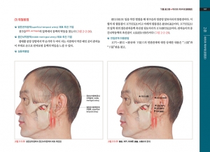 실험침구 표면해부학