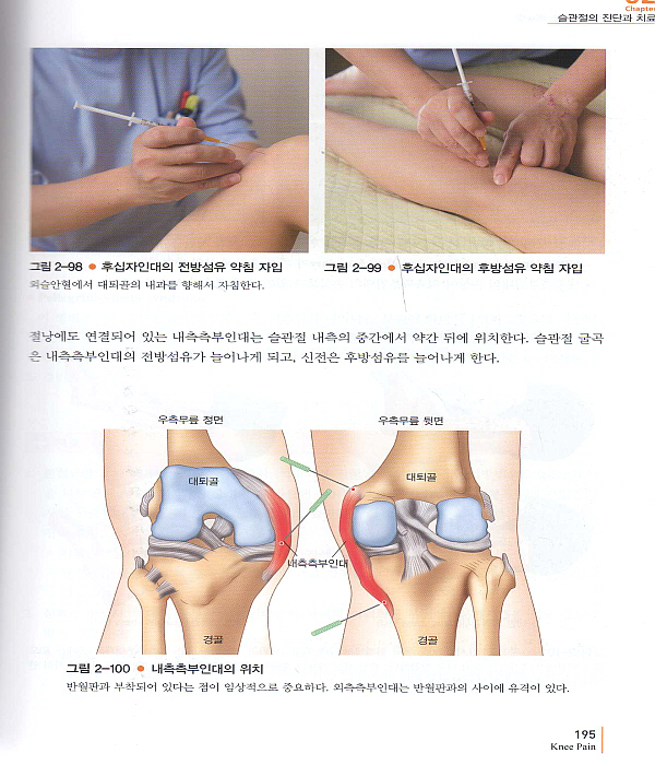 한의사를 위한 통증치료 매뉴얼 Part 2 : 하지 전신자세교정