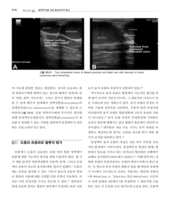 혈관접근‐혈액투석을 위한 혈관수술 (Vascular Access – Principles and Practice) 