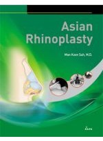 Asian Rhinoplasty