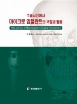 수술교정에서 마이크로 임플란트의 역할과 활용  