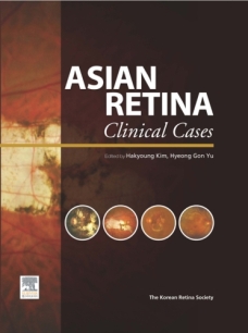 Asian Retina Clinical Cases