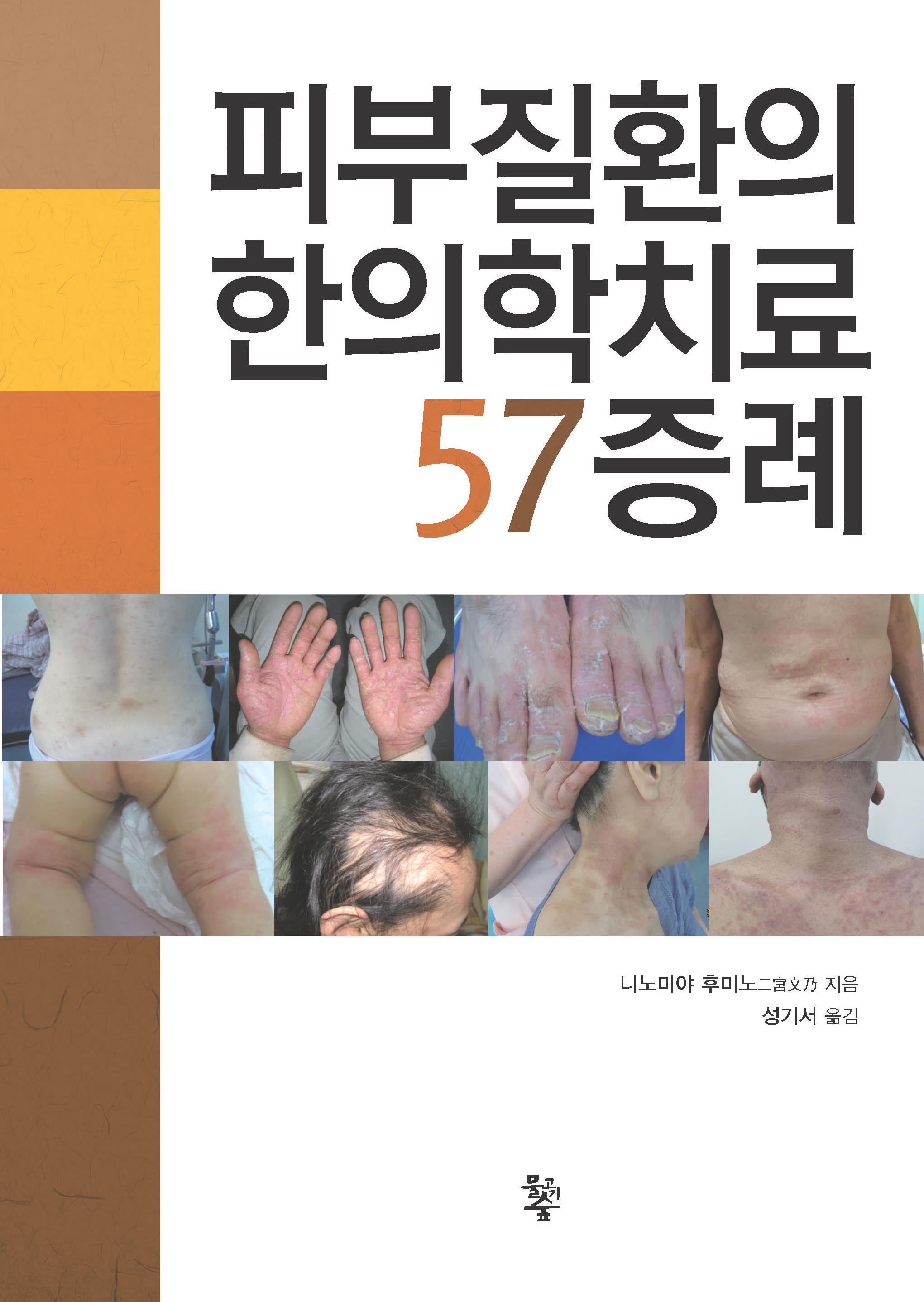 피부질환의 한의학치료 57증례