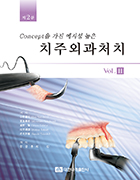 Concept을 가진 예지성 높은 치주외과처치 제2판 Vol.II 