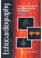 Echocardiography: The Normal Examination and Echocardiographic Measurements [Hardcover] 2th