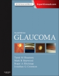 Glaucoma, 2nd Edition (2vols) 2015 