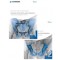Fractures of the Pelvis and Acetabulum: Principles and Methods of Management, 4th   