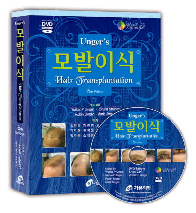  Unger's 모발이식 Hair Transplantation (DVD포함)