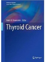 Thyroid Cancer