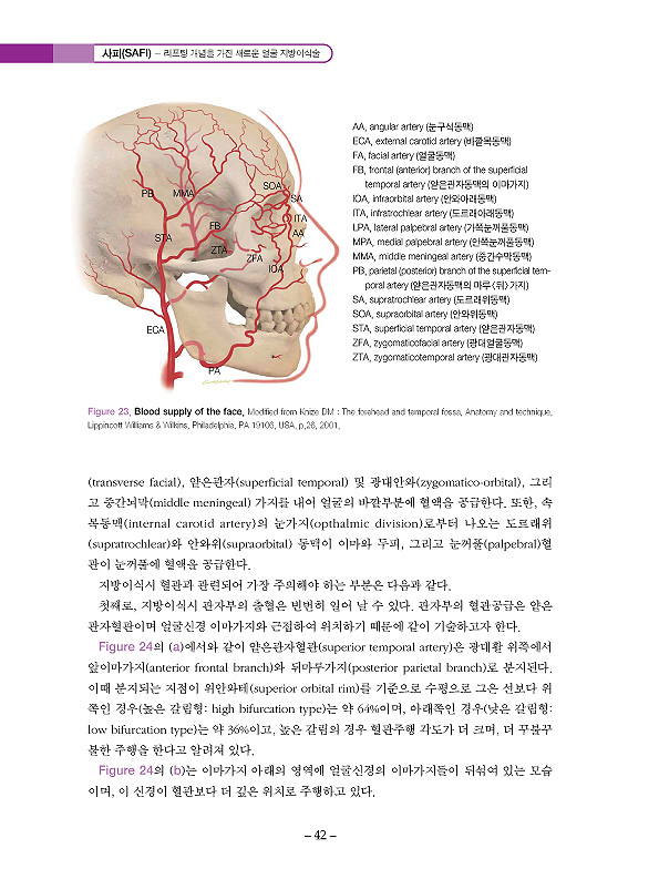 사피(SAFI) - 리프팅 개념을 가진 새로운 얼굴 지방이식술