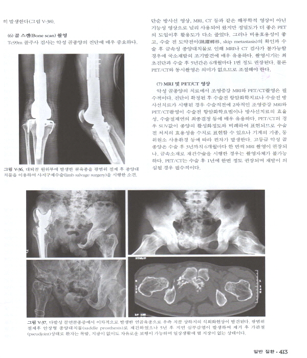 정형외과학 제7판 (2Vols)