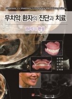 무치악 환자의 진단과 치료 - BPS의 완성