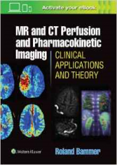 MR & CT Perfusion Imaging: Clinical Applications and Theoretical Principles 