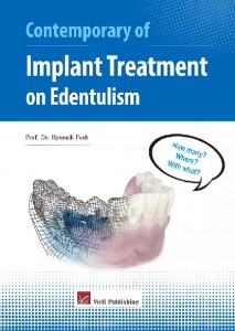 Contemporary of Implant Treatment on Edentulism