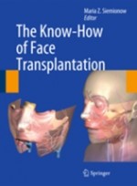 The Know-How of Face Transplantation