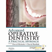 Advanced OPERATIVE DENTISTRY 