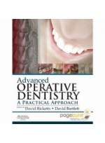 Advanced OPERATIVE DENTISTRY 