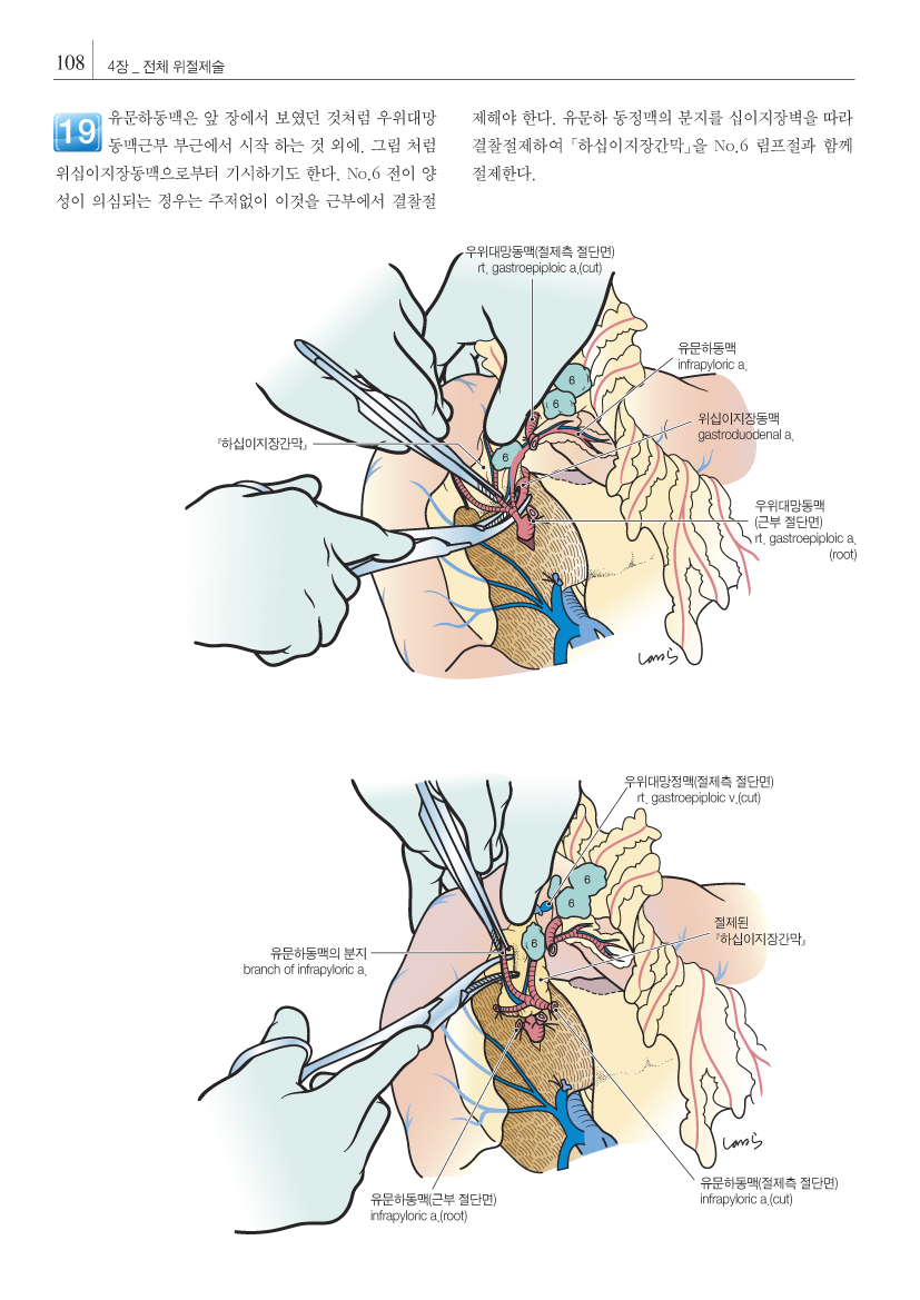 그림으로 보는 외과수술 아틀라스-복부 해부에 의한 수술 포인트   