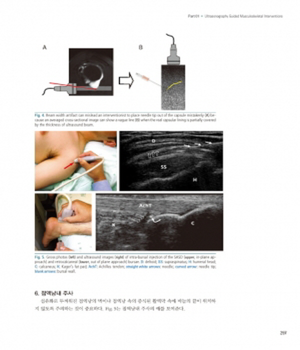 신경근골격 초음파(Neuromusculoskeletal Ultrasonography)