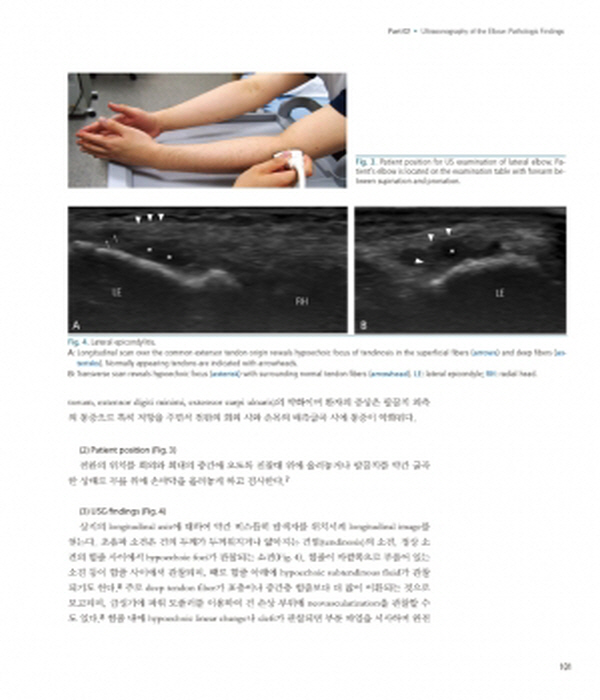 신경근골격 초음파(Neuromusculoskeletal Ultrasonography)