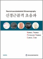 신경근골격 초음파(Neuromusculoskeletal Ultrasonography)