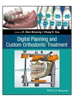 Digital Planning and Custom Orthodontic Treatment 