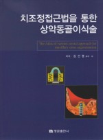 치조정접근법을 통한 상악동 골이식술