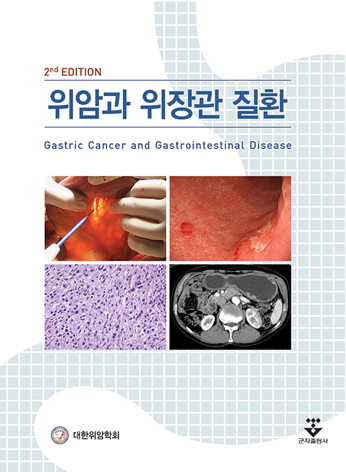 위암과 위장관 질환 