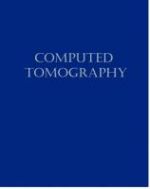 Computed Tomography