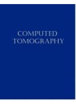 Computed Tomography