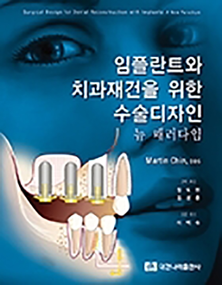 임플란트와 치과재건을 위한 수술 디자인 뉴 페러다임