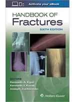 Handbook of Fractures 6e