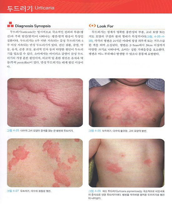 시각 진단: 핵심 소아 피부과 Visual Dx: Essential Pediatric Dermatology   