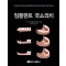 임플란트 국소의치