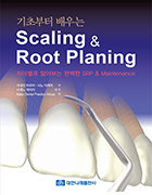 기초부터 배우는 Scaling & Root Planing