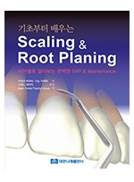 기초부터 배우는 Scaling & Root Planing