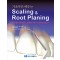 기초부터 배우는 Scaling & Root Planing