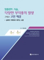 임플란트 시술, 다양한 부작용의 발생 그리고 고민 해결 - 실패의 극복에서 배우는 교훈 