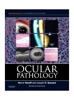 Ocular Pathology,7/e