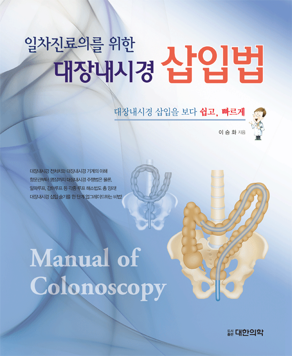 대장내시경 삽입법 - 일차진료의를 위한