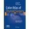 Color Atlas of Thyroid Surgery: Open, Endoscopic and Robotic Procedures