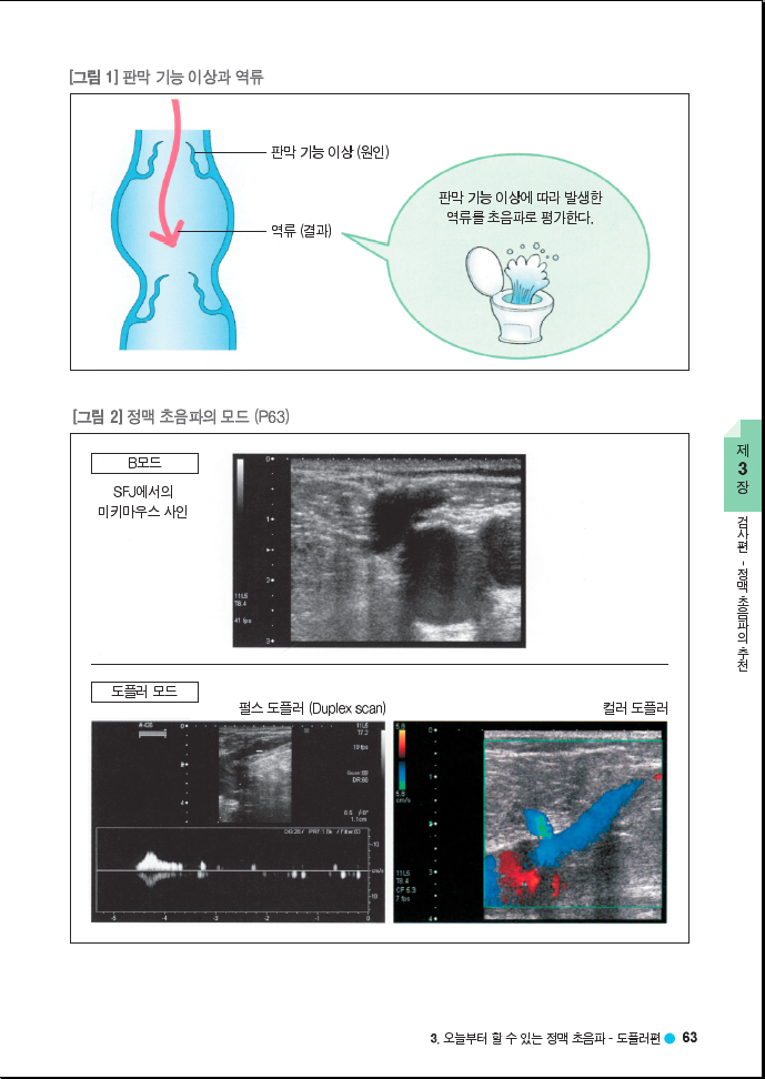 하지정맥류 진단,치료 그것이 알고 싶다! 