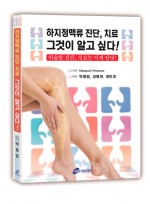 하지정맥류 진단,치료 그것이 알고 싶다! 