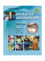 Operative Arthroscopy,4/e