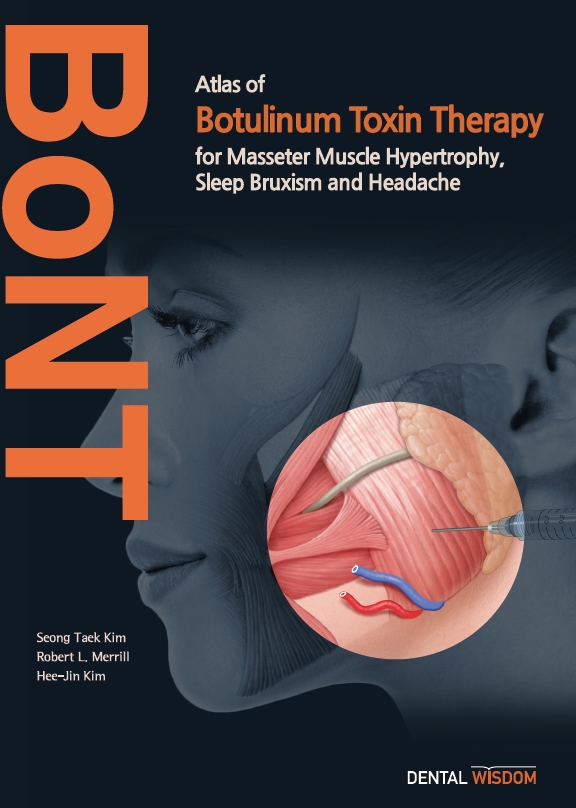 Atlas of Botulinum Toxin Therapy for Masseter Muscle Hypertrophy, Sleep Bruxism and Headache