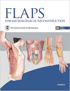 Flaps for Microsurgical Reconstruction 