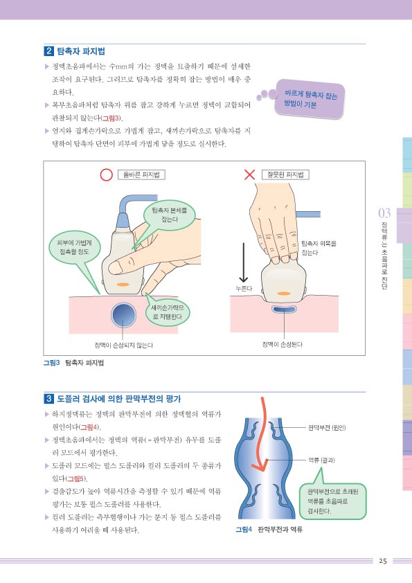 하지정맥류 혈관내 레이저 치료   