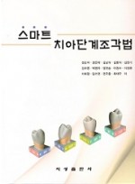 스마트 치아단계조각법