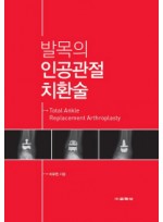 발목의 인공관절 치환술