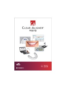 CA 투명교정 